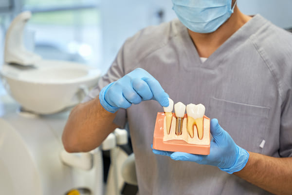 poner implantes dentales